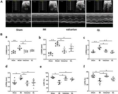 Qiliqiangxin Modulates the Gut Microbiota and NLRP3 Inflammasome to Protect Against Ventricular Remodeling in Heart Failure